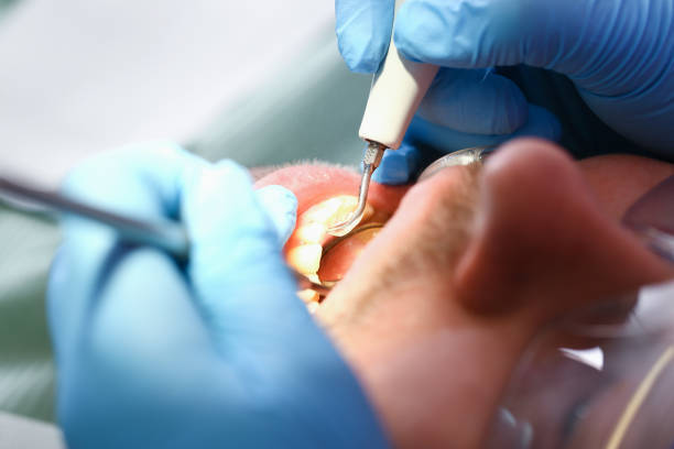Best Cosmetic Emergency Dentistry in Roma, TX